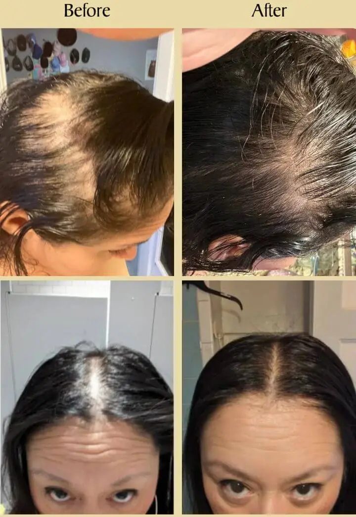 Veganic Oil Veganic Natural Hair Growth Oil